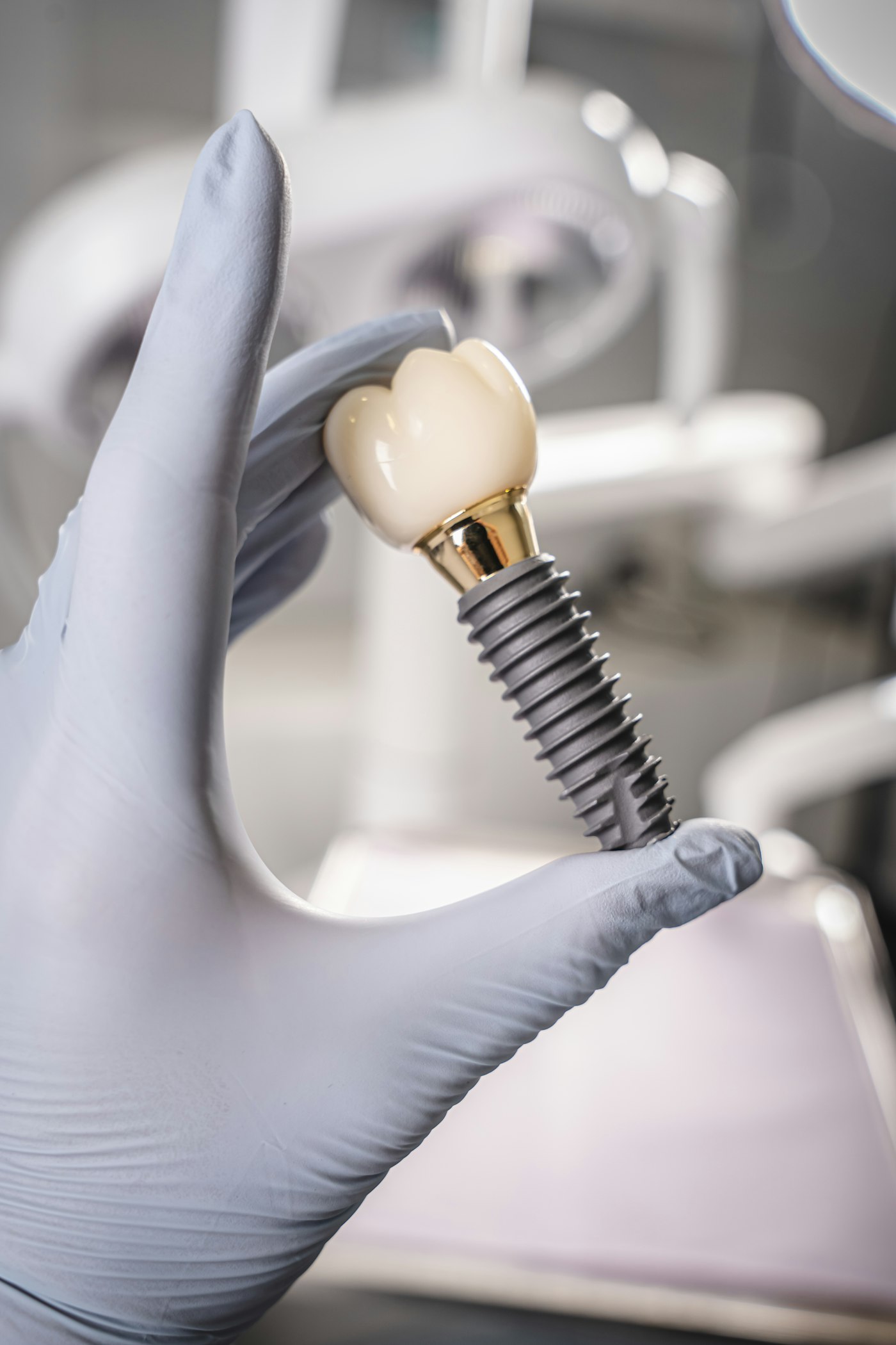 A gloved hand holding a dental implant with its crown attached